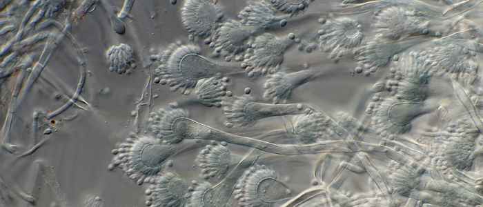 Aspergillus fumigatus, often azole resistant and difficult to treat (photo: Jos Houbraken, WI-KNAW)