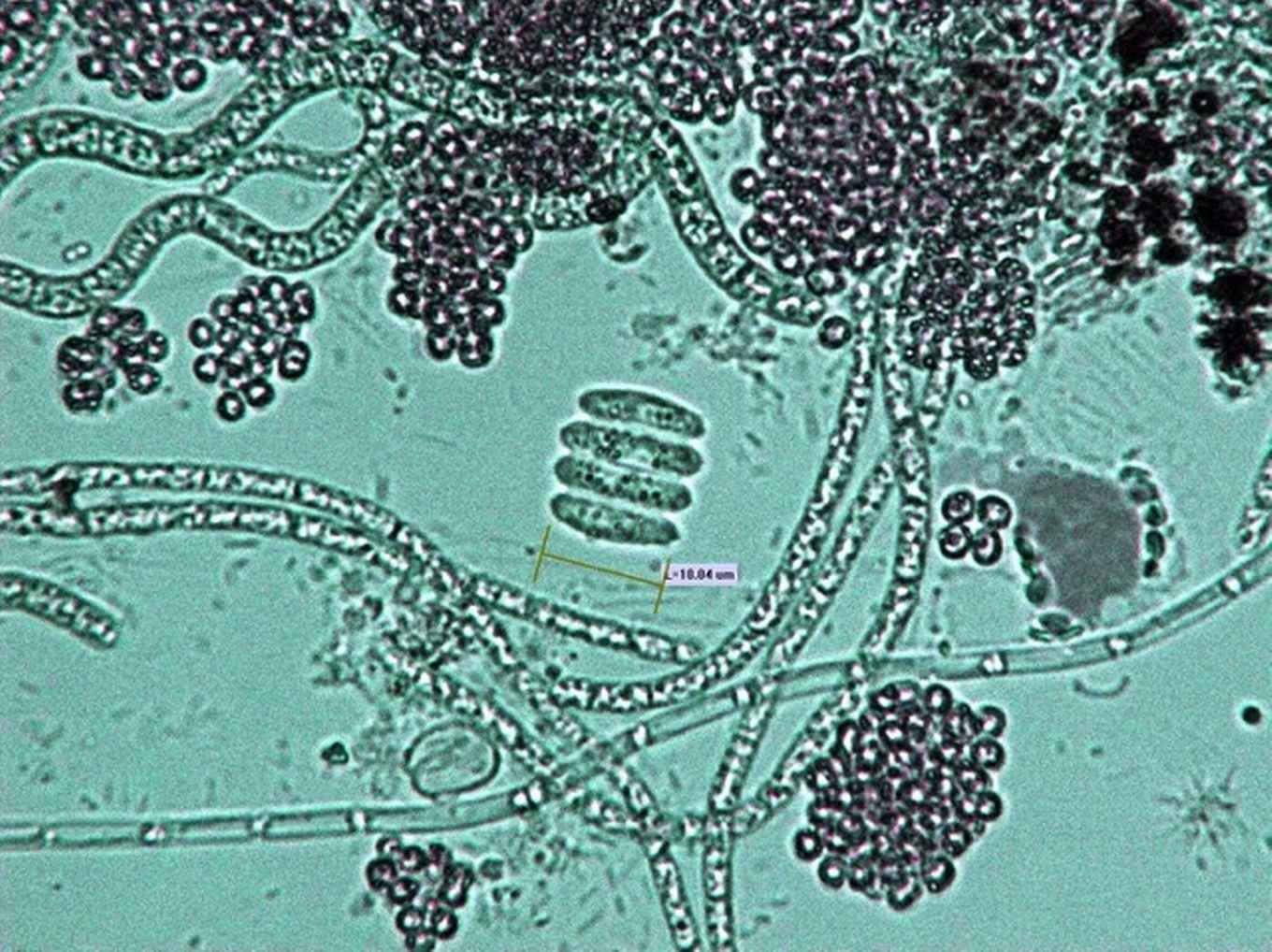 Microorganisms Lake Vechten